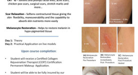 Collagen Rejuvenation Therapy, Micro Needling Class
