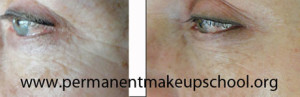 Pre and Post Skin Needling from www.permanentmakeupschool.org